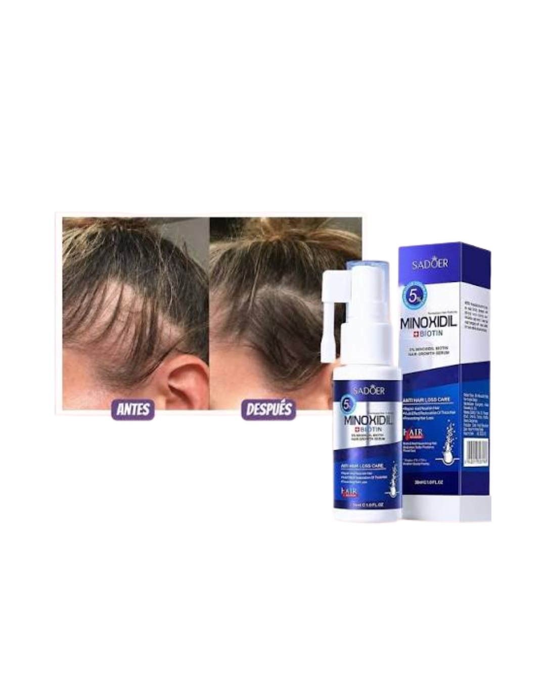 Sérum Anticaída Capilar con Minoxidil 5% y Biotina