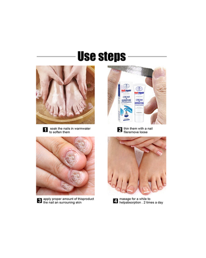 Crema reparadora de uñas Antihongo